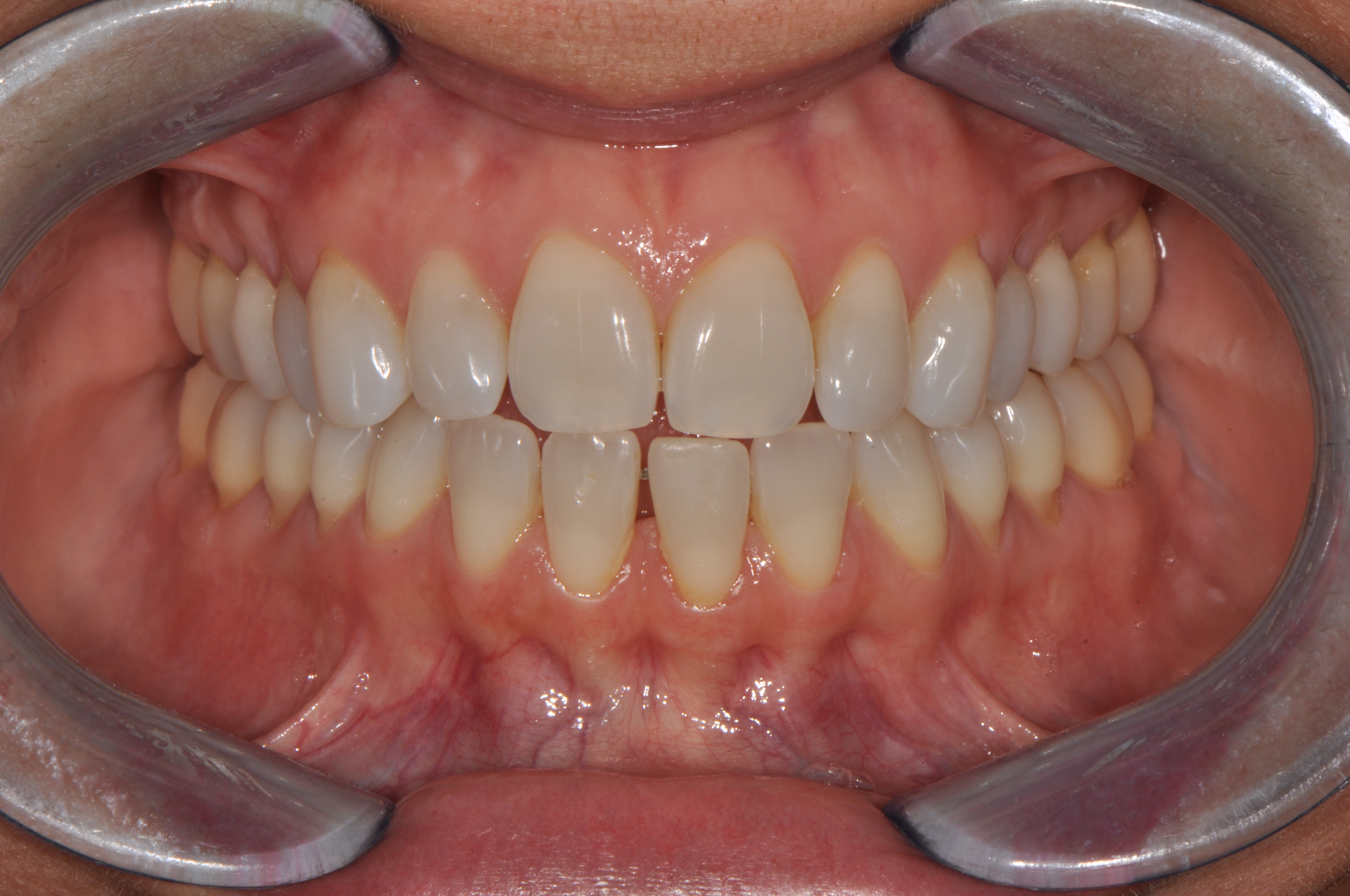 Intraoral dataset preview