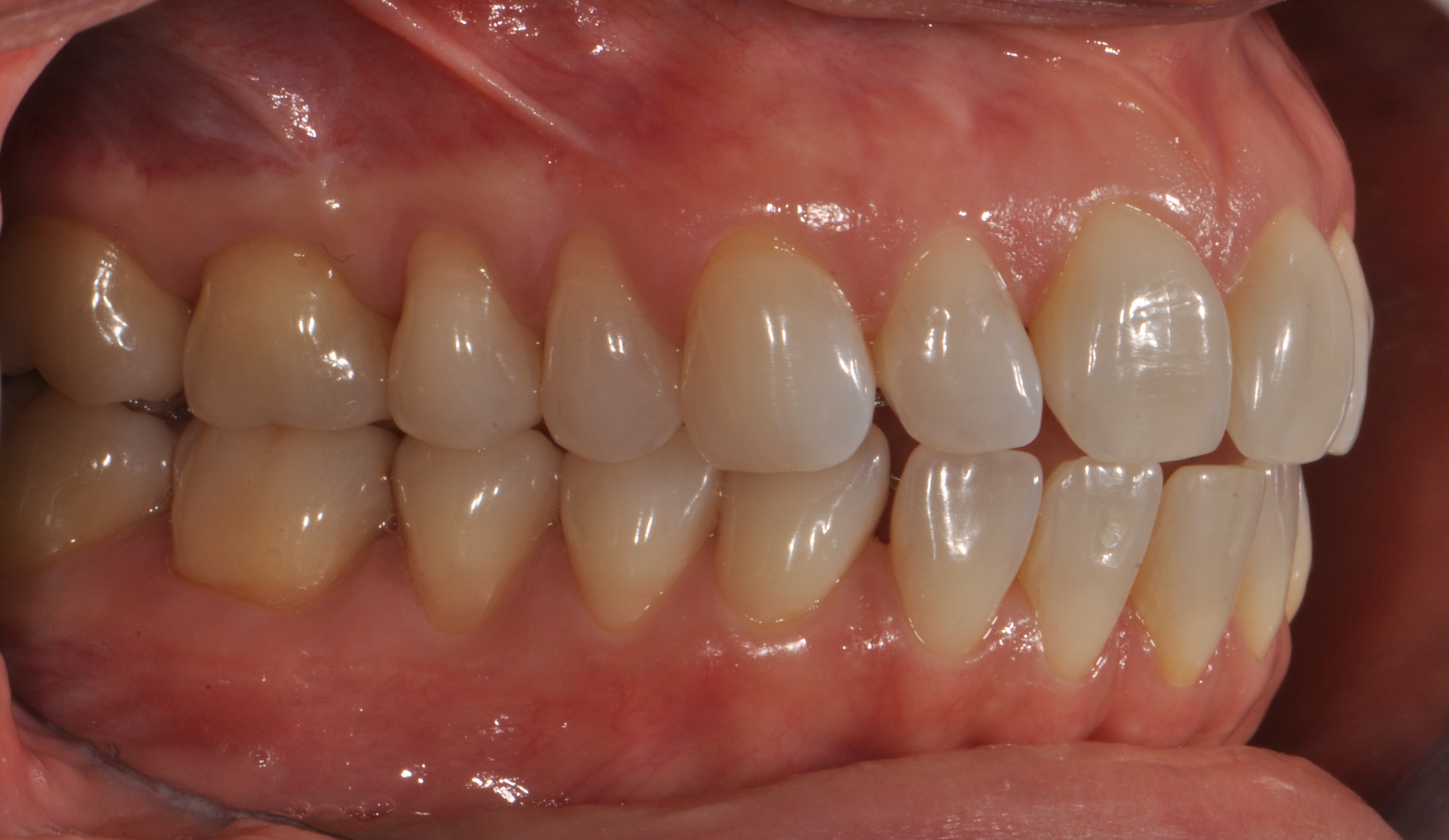 Intraoral dataset preview