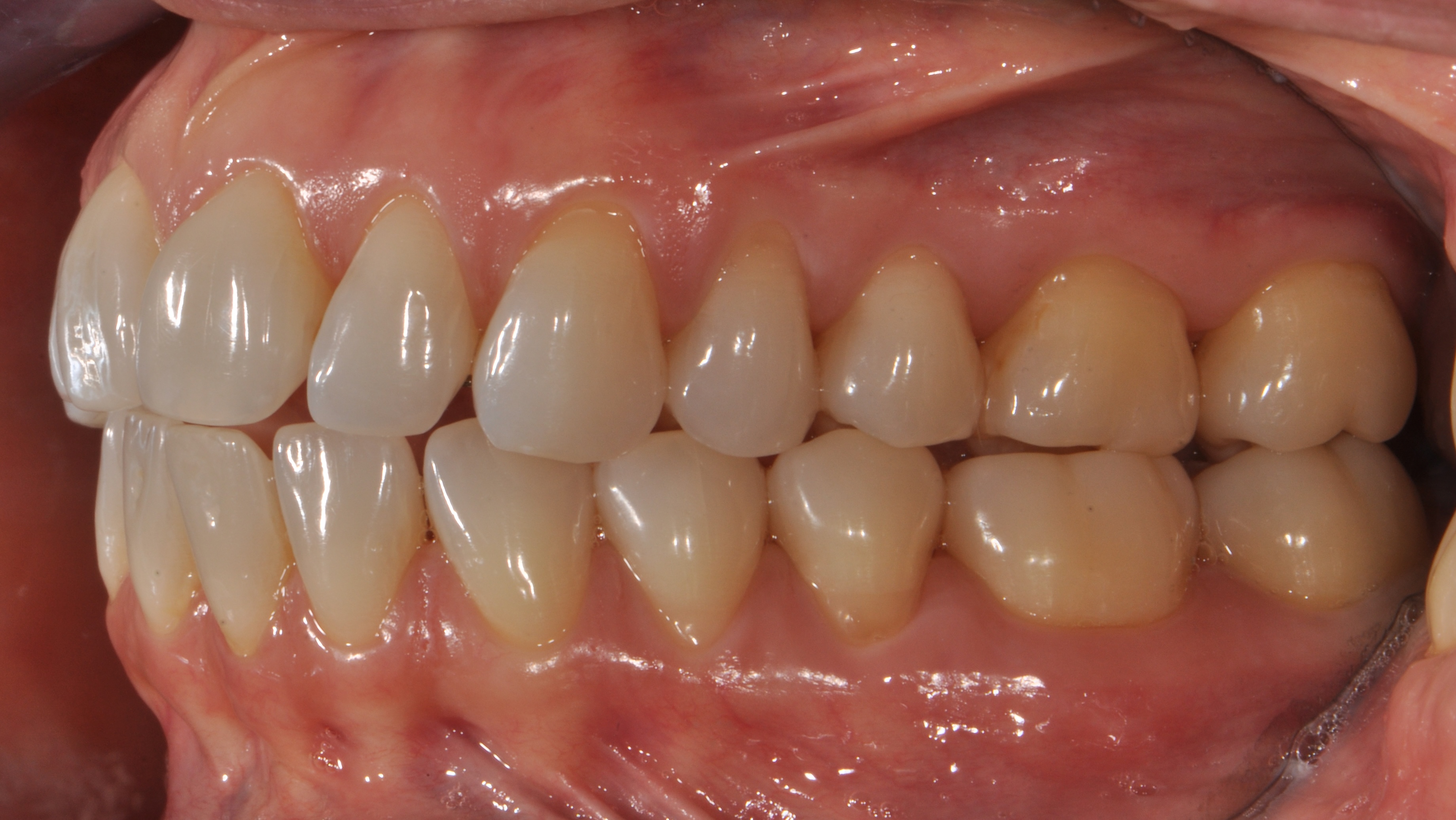 Intraoral dataset preview