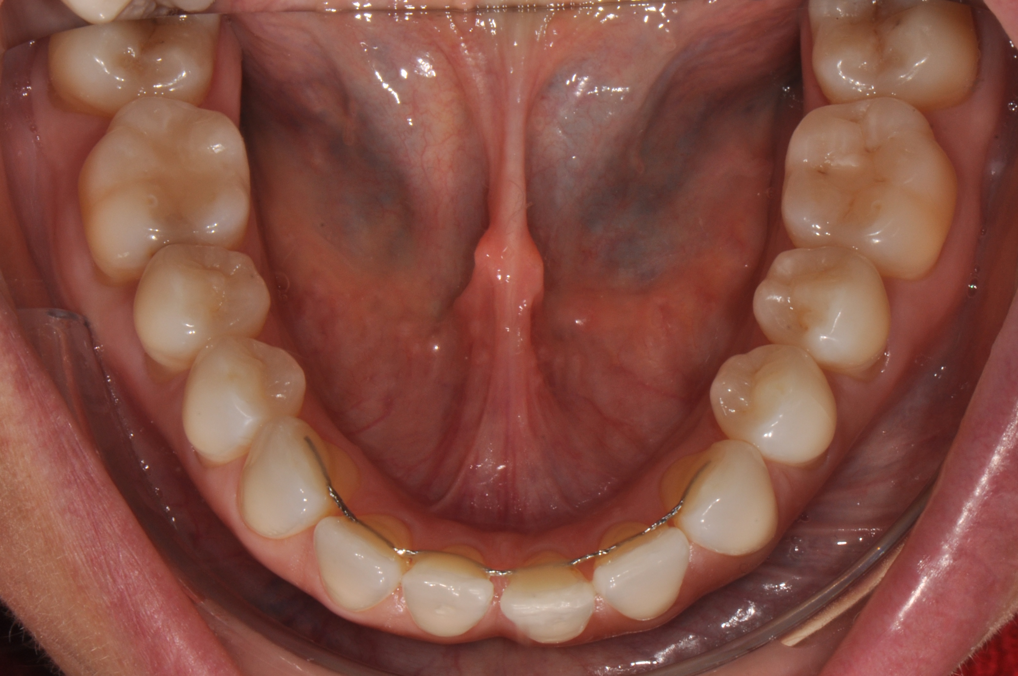 Intraoral dataset preview