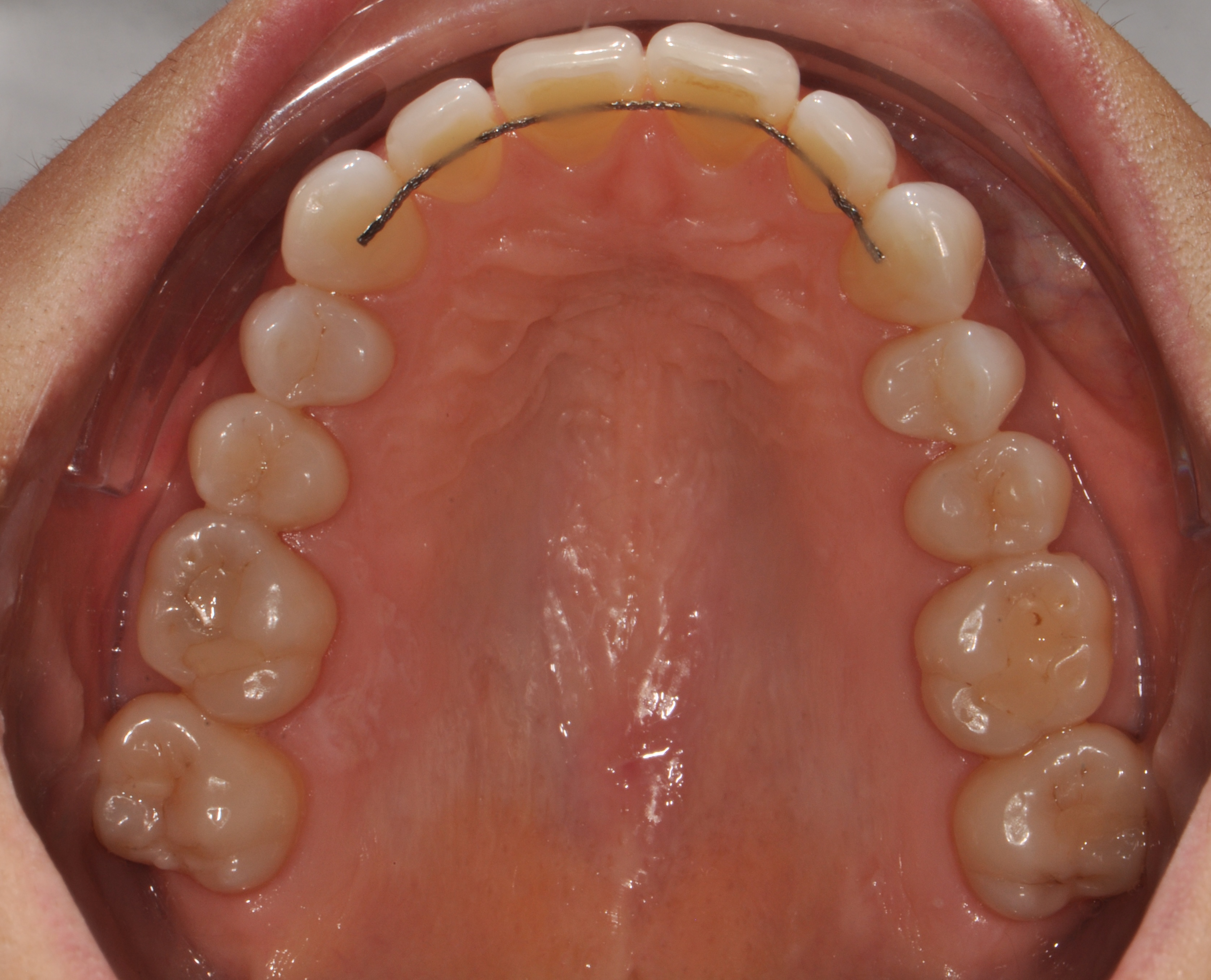 Intraoral dataset preview