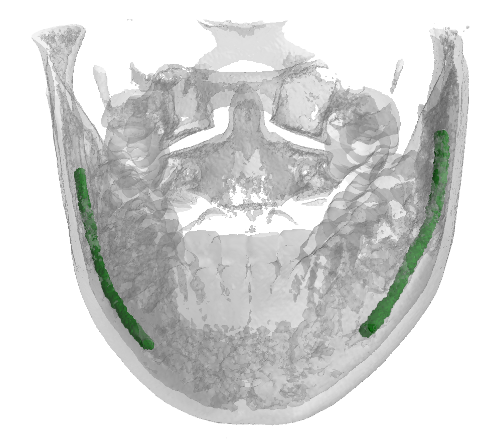 mandibular pic