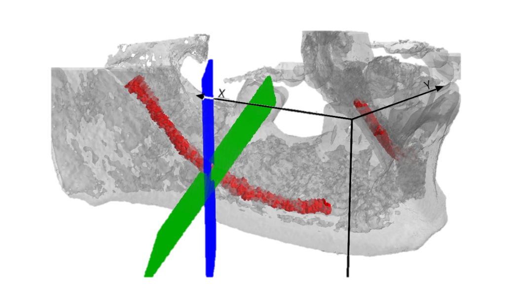 mandibular pic