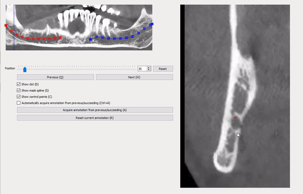 Animated gif of the tool functionalities