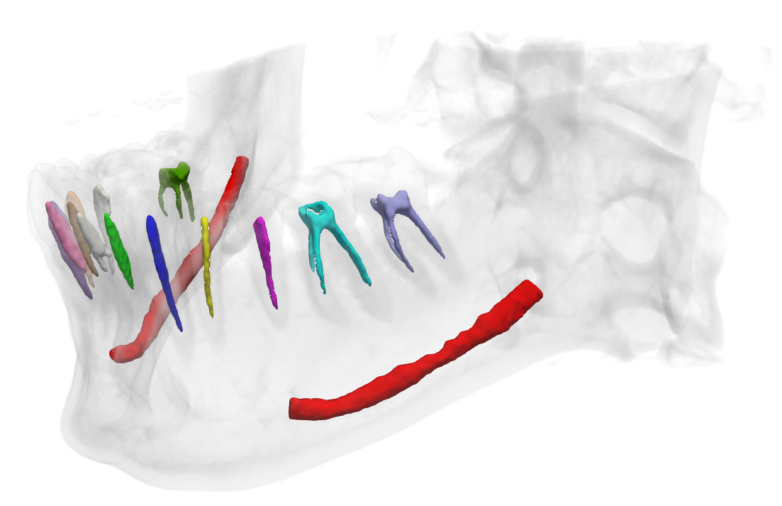 mandibular pic