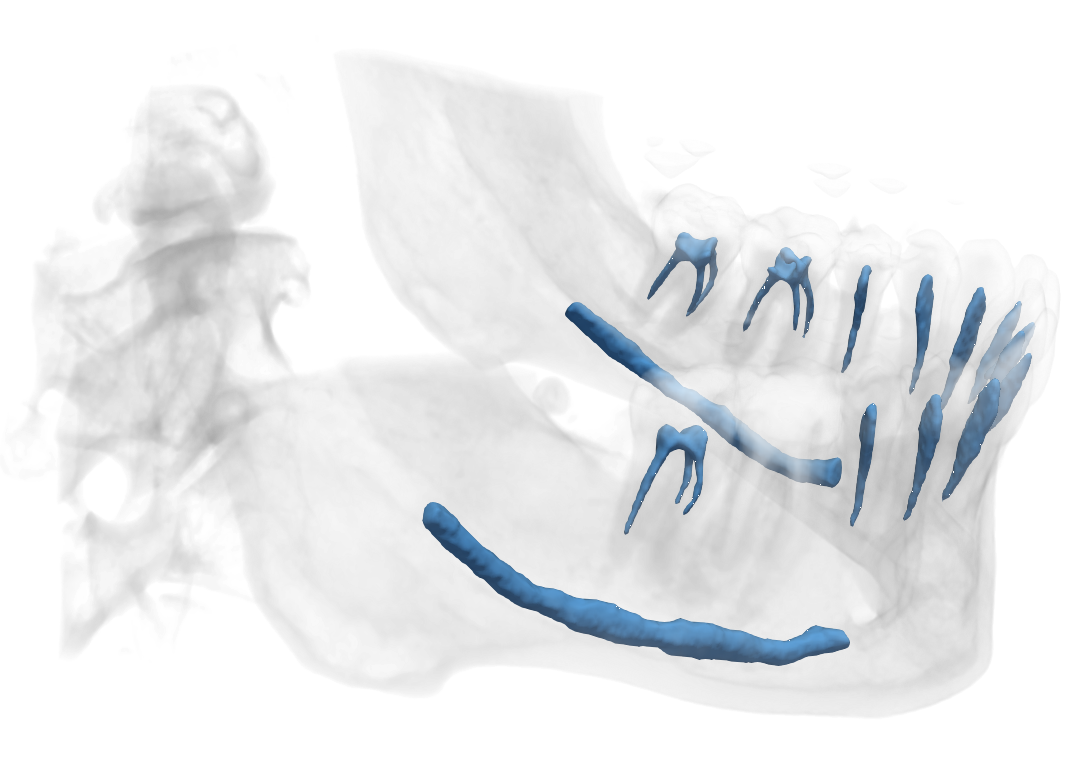 mandibular pic