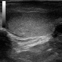 TesticulUS Image 3