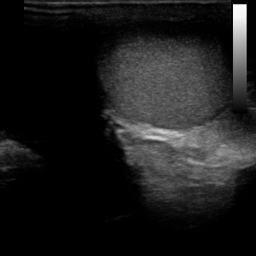 TesticulUS Image 4