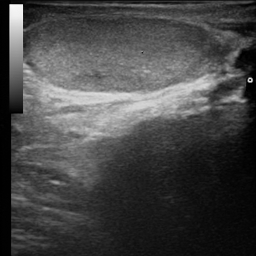 TesticulUS Image 4