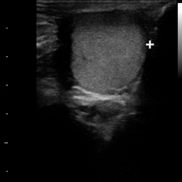 TesticulUS Image 1