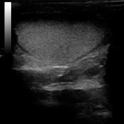 TesticulUS Image 2