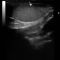 TesticulUS Image 4