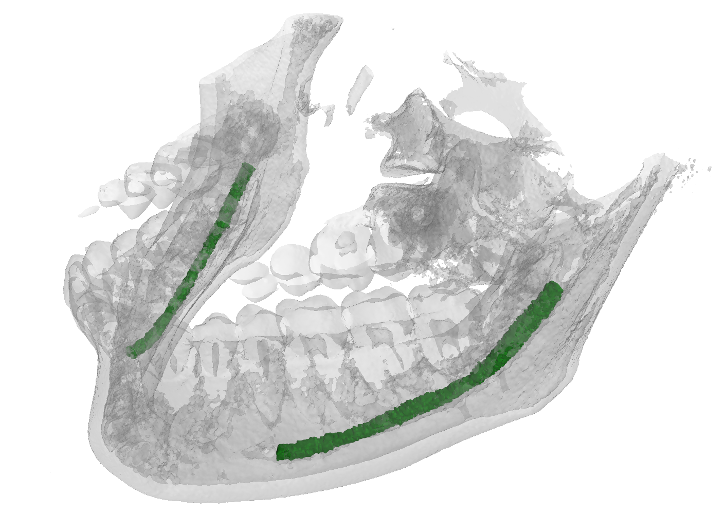 mandibular pic