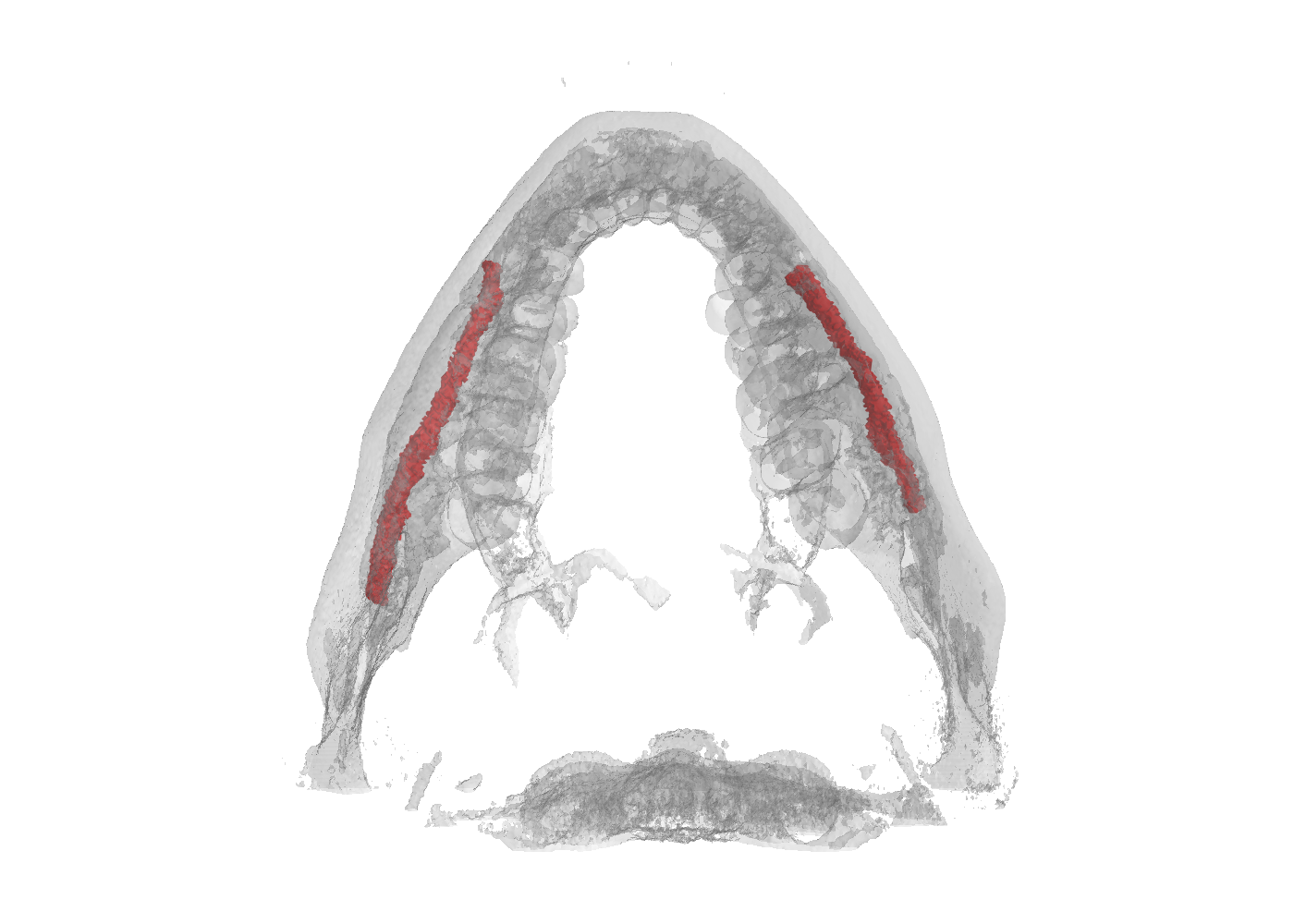 mandibular pic