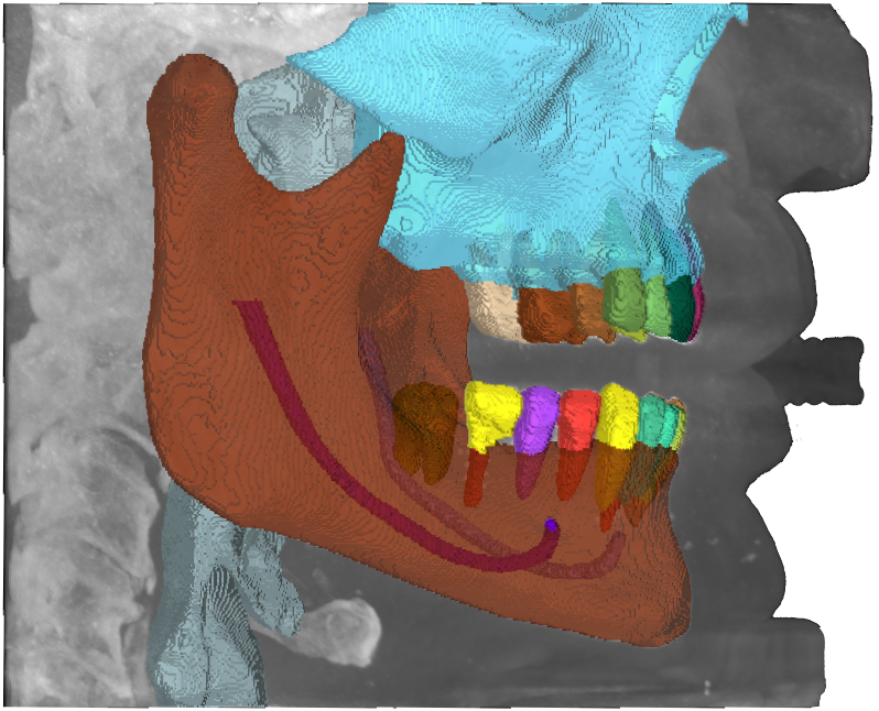 mandibular pic