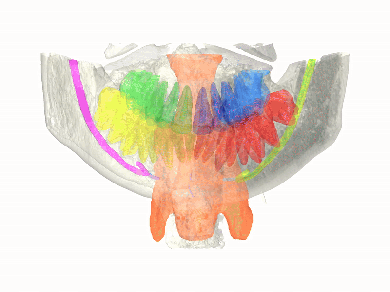 mandibular pic