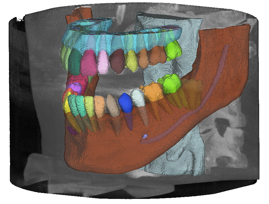 mandibular pic